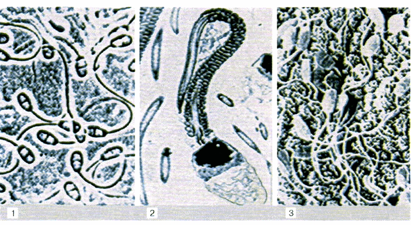 Рис. 20. Изображения сперматозоидов кролика, полученные с помощью микроскопов: 1 — светового; 2 — электронного трансмиссионного; 3 — электронного сканирующего